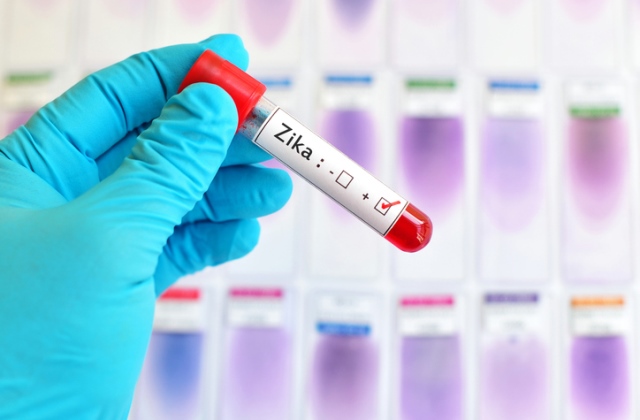 3 éven belül magától megállhat a zika-járvány terjedése