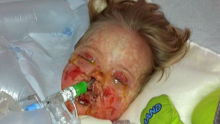 Drámai reakciót váltott ki egy antibiotikum