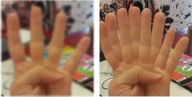 10 dolog, amit csak a szemüvegesek érthetnek meg