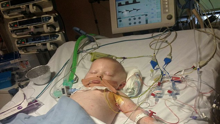 Majdnem meghalt a kisfiú, akinek bárányhimlőjéről kiderült, hogy húsevő baktérium