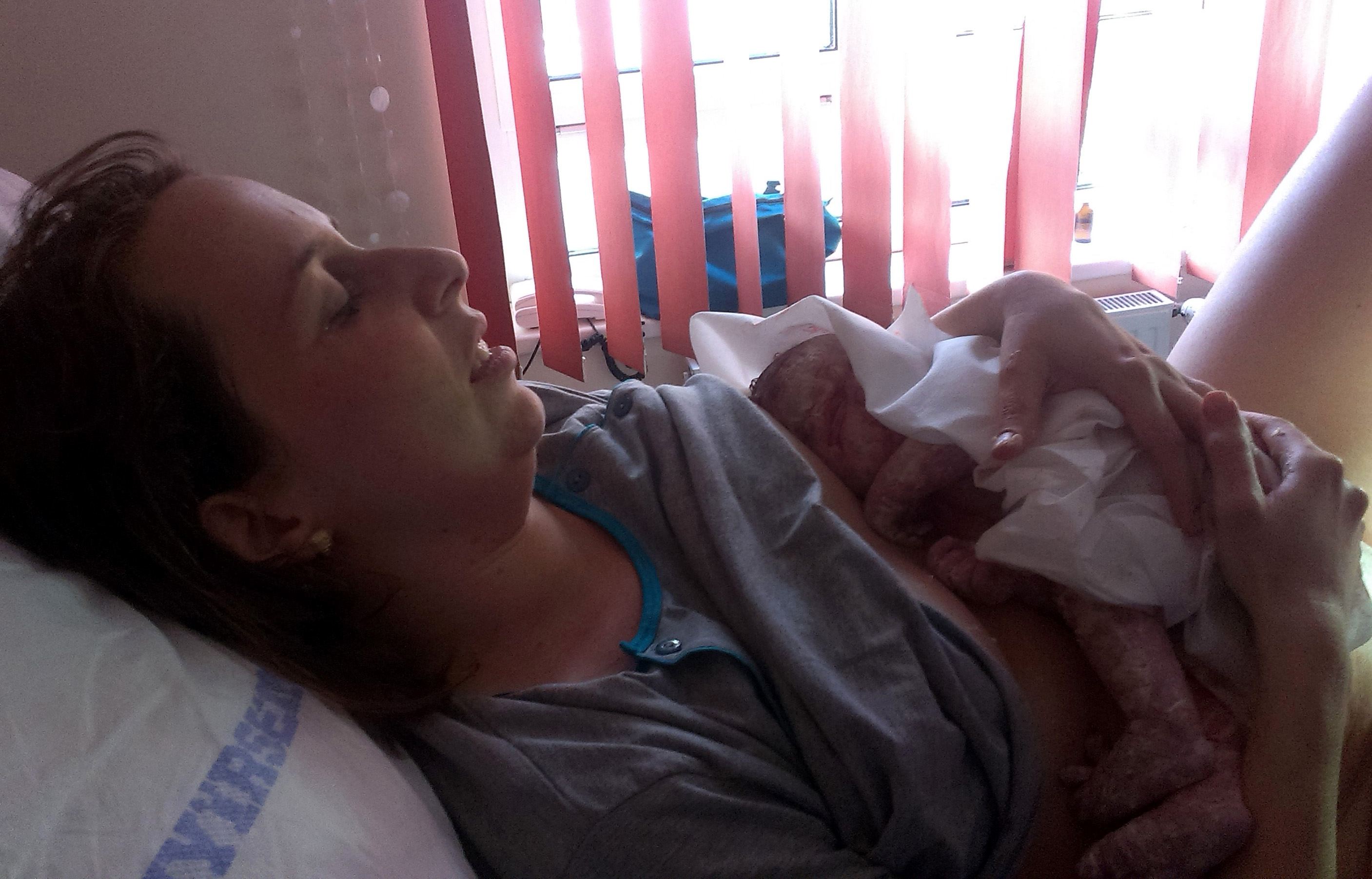 Császármetszés után természetesen: 