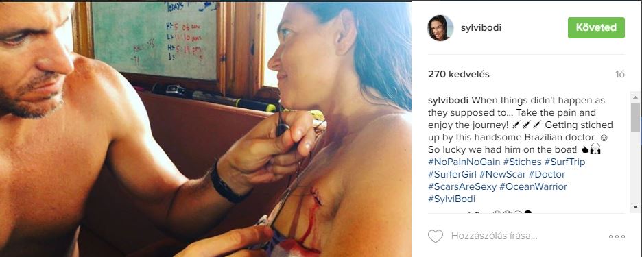 Bódi Sylvi csúnyán megsérült, brazol orvos varrta össze