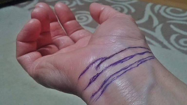 Neked vannak ilyen csíkok a csuklódon? Ezt jelentik