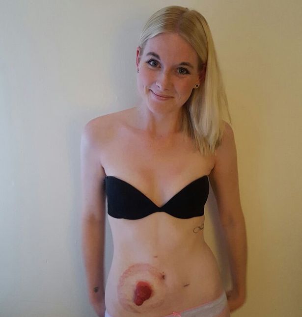 Ki akarták zavarni az uszodából, nem hagyta magát a fiatal nő 