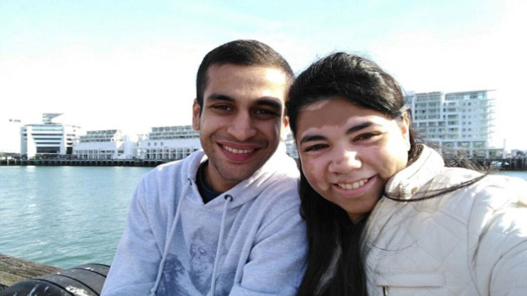 Meztelen fotókkal ünnepli testét a vitiligós lány Meztelen fotókkal ünnepli testét a vitiligós lány