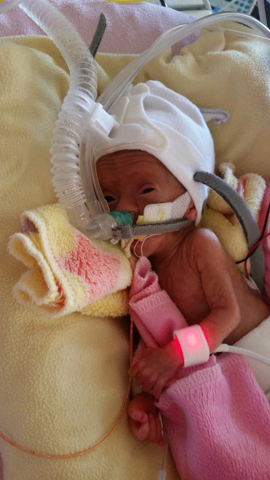 Instagramon dokumentálta az anyuka, hogyan küzd az életéért koraszülött babája