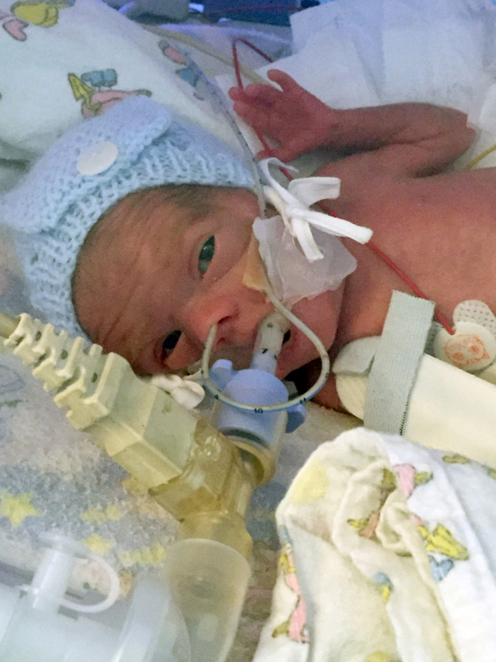 24 hetesen, fél kilóval jött a világra Nagy-Britannia legkisebb korababája - túlélte