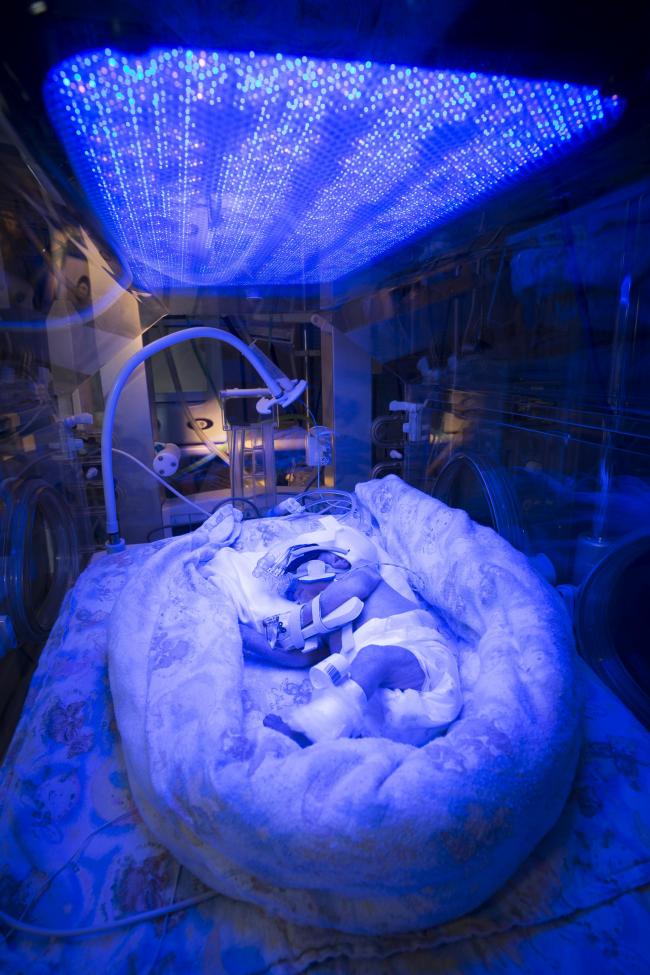 Díjat nyert ez a koraszülött babáról készült fotó