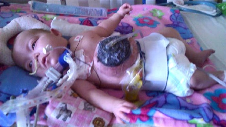 Megható: örökbe fogadta a nővér a koraszülött babát