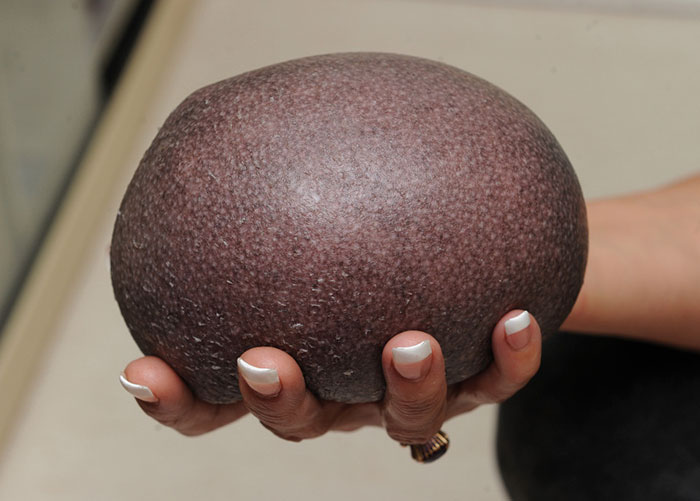 Ő Nelson, a világ egyetlen kopasz sünije - fotók