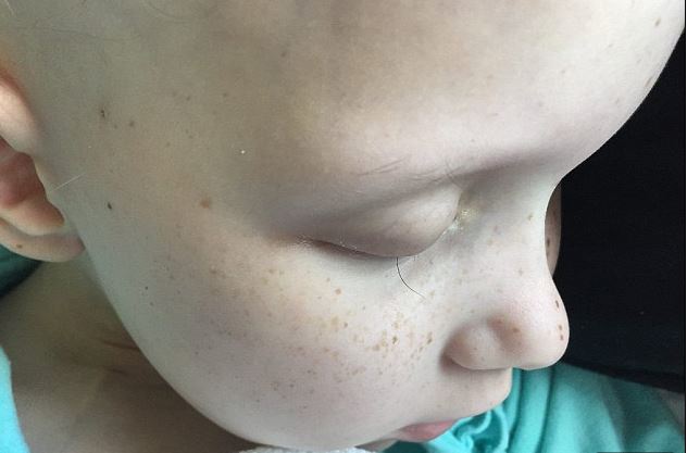 Egy világot ríkatott meg az ausztrál apuka kislánya fotójával 