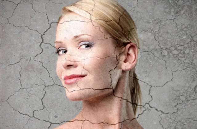 Ezek okozzák leggyakrabban a bőrszárazságot