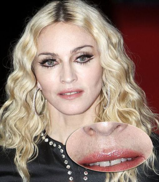 7 tökéletlen sztár, akiket mégis szépnek látunk 7 tökéletlen sztár, akiket mégis szépnek látunk