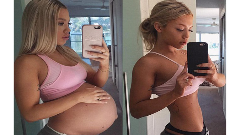 2016 kismamái, akik szülés után megmutatták a hasukat