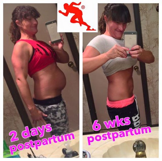 2016 kismamái, akik szülés után megmutatták a hasukat