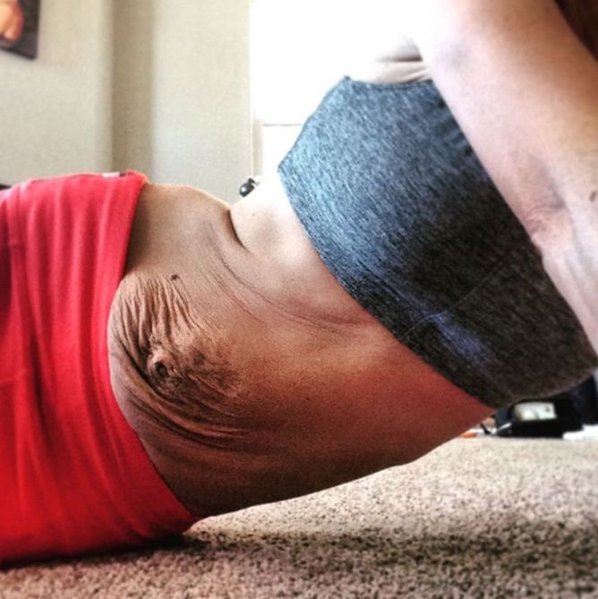 2016 kismamái, akik szülés után megmutatták a hasukat