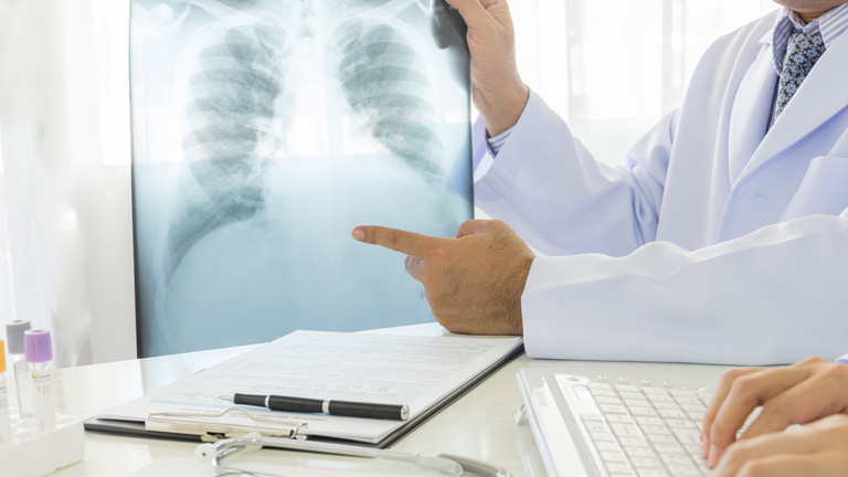 Ezért még lesz hálás a férjed – ajándékozz neki orvosi szűrést