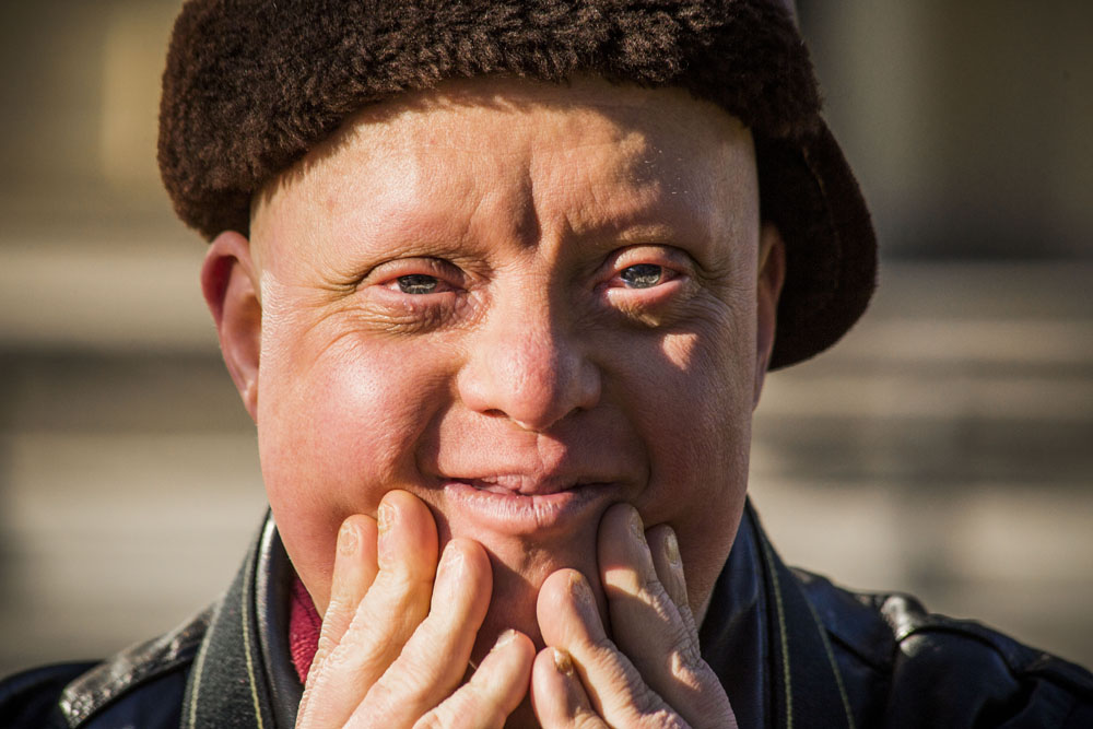 Zozó a Down-szindrómás fotós