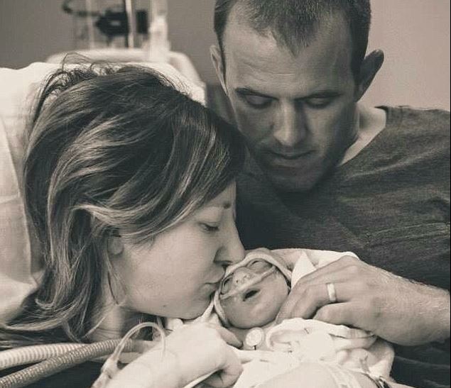 Szívszaggató okból hordta ki halálos beteg babáját az anya