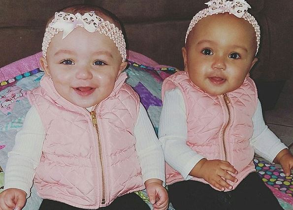 Senki sem hiszi el erről a két kislányról, hogy ikrek