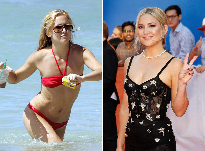 Kate Hudson a mellplasztika előtt és után (Fotó: Profimedia)