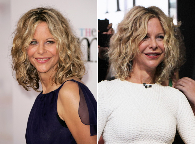 Meg Ryan a túlzásba vitt botox élő példája (Fotó: Profimedia)
