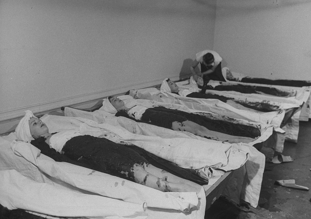 Ilyen szépségpraktikákkal kínozták magukat régen a nők