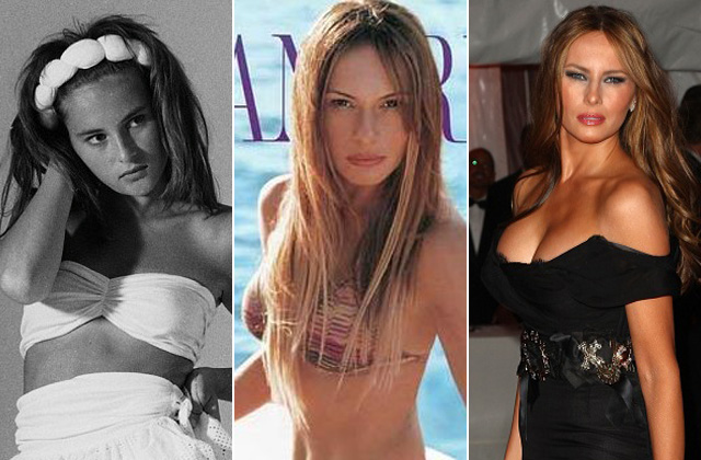 Így nézett ki Melania Trump a plasztikai műtétei előtt Így nézett ki Melania Trump a plasztikai műtétei előtt