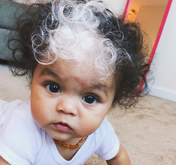 Gigantikus bozonttal született a kisfiú – az orvosoknak tátva maradt a szája 