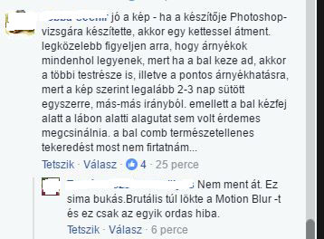 Kiss Ramóna köldökét is kiretusálták Kiss Ramóna köldökét is kiretusálták