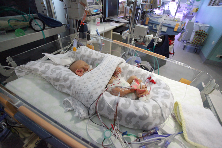 Miért óriási küzdelem életben tartani a korababákat?