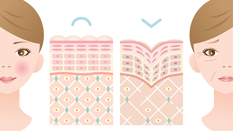 Kollagén és hyaluronsav, a feszes bőr titka?