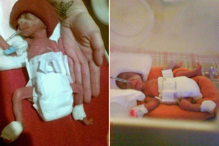 A hit, a remény és a szeretet tartotta életben a picit A hit, a remény és a szeretet tartotta életben a picit