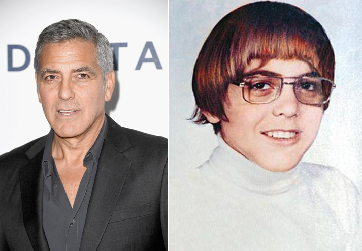 Minden kezdet nehéz – világszép celebek, akik rút kiskacsának születtek Minden kezdet nehéz – világszép celebek, akik rút kiskacsának születtek