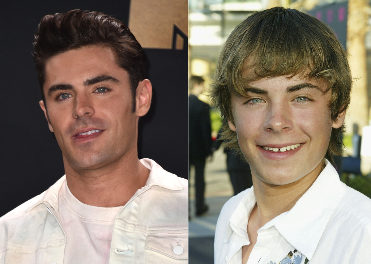 Minden kezdet nehéz – világszép celebek, akik rút kiskacsának születtek Minden kezdet nehéz – világszép celebek, akik rút kiskacsának születtek