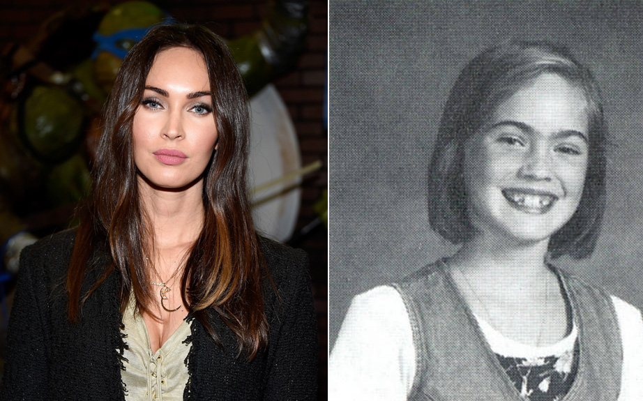 Minden kezdet nehéz – világszép celebek, akik rút kiskacsának születtek Minden kezdet nehéz – világszép celebek, akik rút kiskacsának születtek