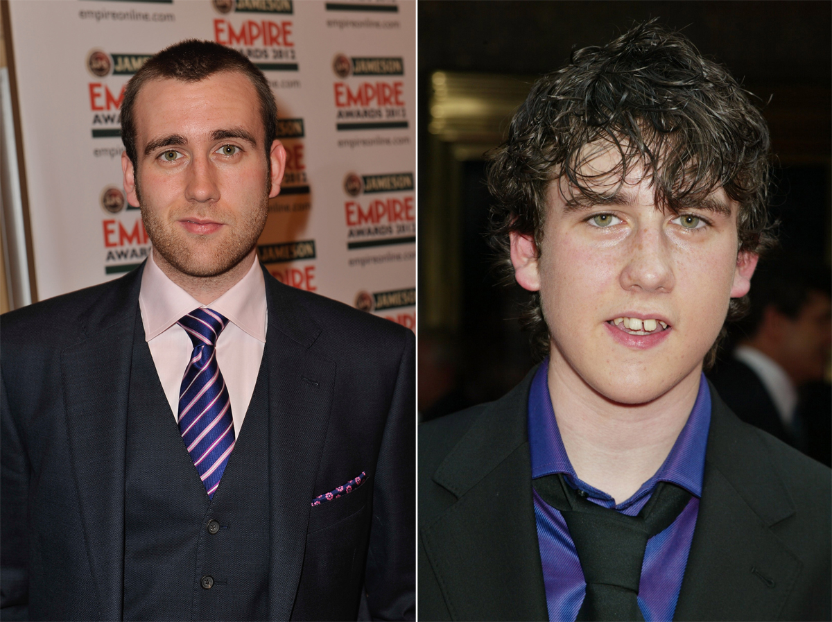 Minden kezdet nehéz – világszép celebek, akik rút kiskacsának születtek Minden kezdet nehéz – világszép celebek, akik rút kiskacsának születtek