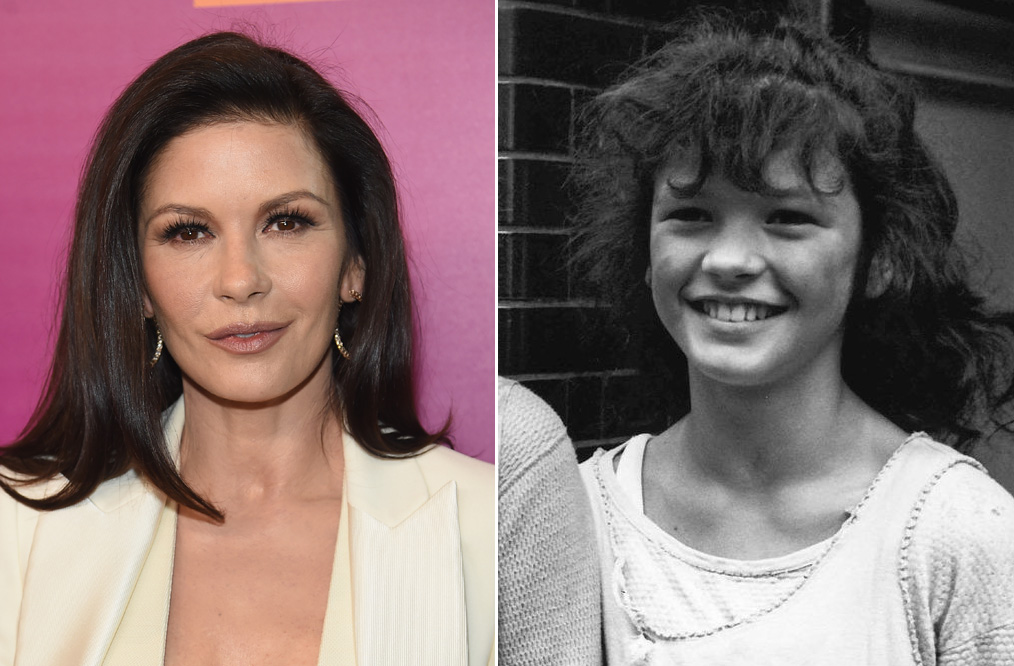 Minden kezdet nehéz – világszép celebek, akik rút kiskacsának születtek Minden kezdet nehéz – világszép celebek, akik rút kiskacsának születtek