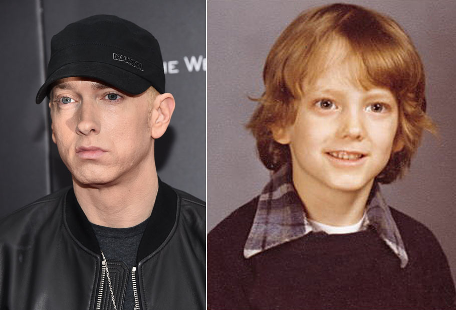 Minden kezdet nehéz – világszép celebek, akik rút kiskacsának születtek Minden kezdet nehéz – világszép celebek, akik rút kiskacsának születtek