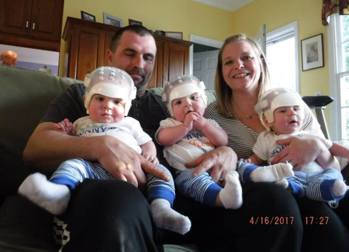 Történelmet írtak a ritka betegséggel született hármas ikrek 