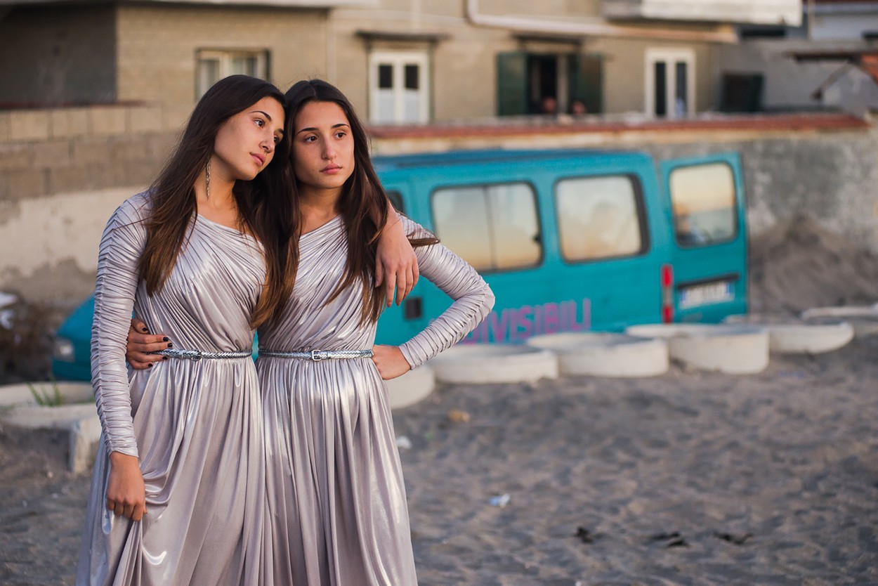 Elválaszthatatlanok: Egy sziámi ikerpár, akik felnőttként kapták meg az esélyt a szétválásra