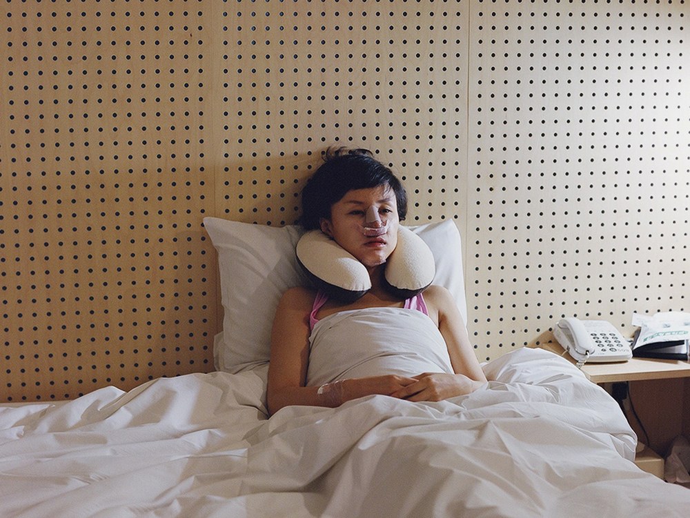 Élet, közvetlenül a plasztikai műtét után - meghökkentő fotók