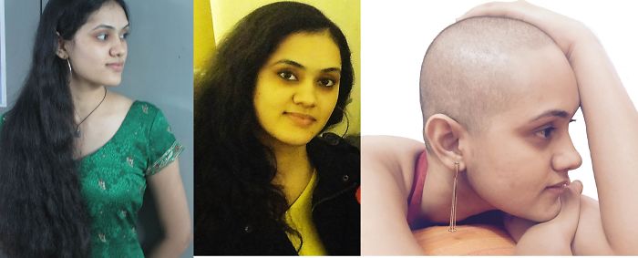 Elképesztő előtte-utána fotók nagy hajátalakulásokról