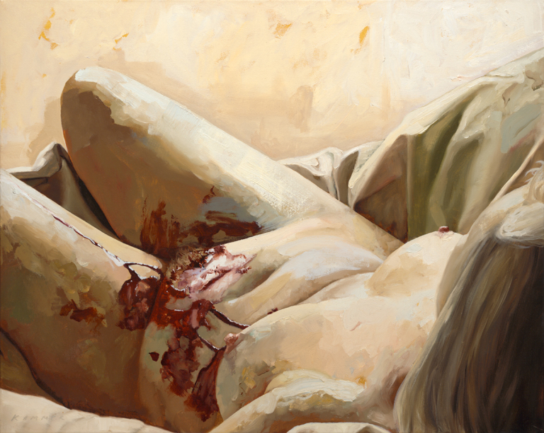 Így néz ki az endometriózis húsbavágó festményeken