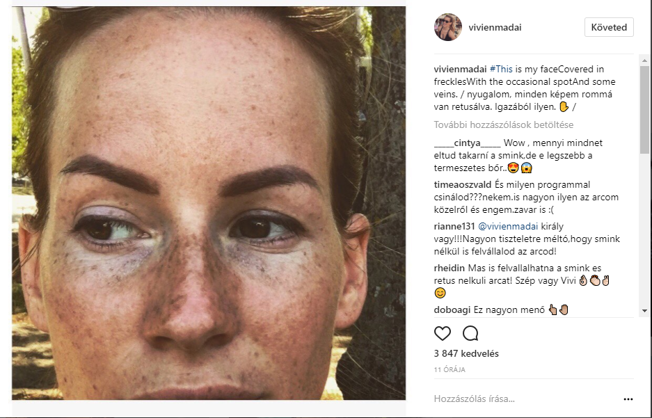 Mádai Vivien retusálva, vagy retusálatlanul jobb?