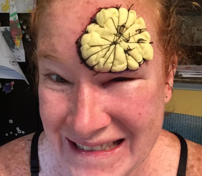 Döbbenetesen erős képekkel mutatja be egy anyuka, miért ne napozzunk naptej nélkül 