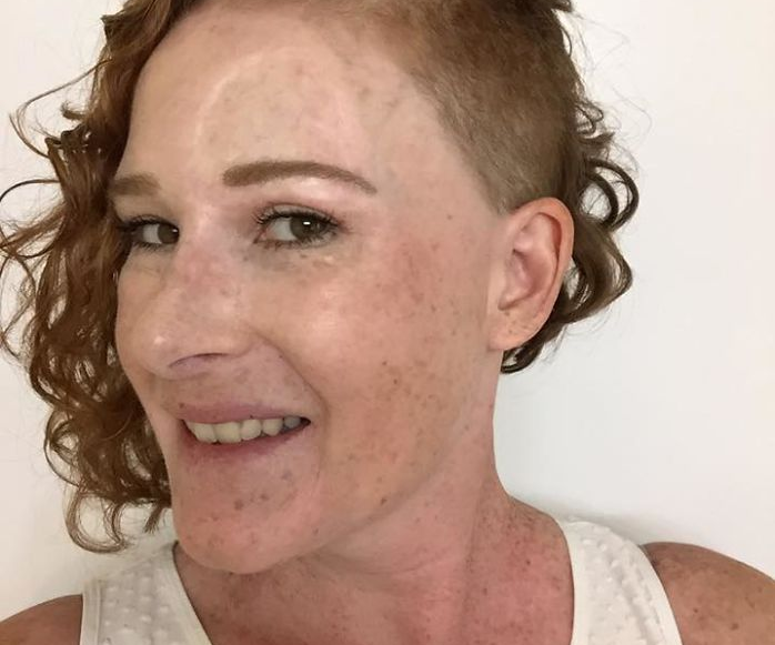 Döbbenetesen erős képekkel mutatja be egy anyuka, miért ne napozzunk naptej nélkül 