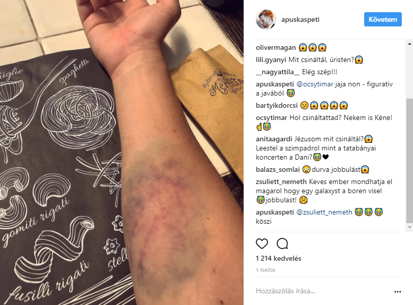 Durva balesete volt Puskás Petinek