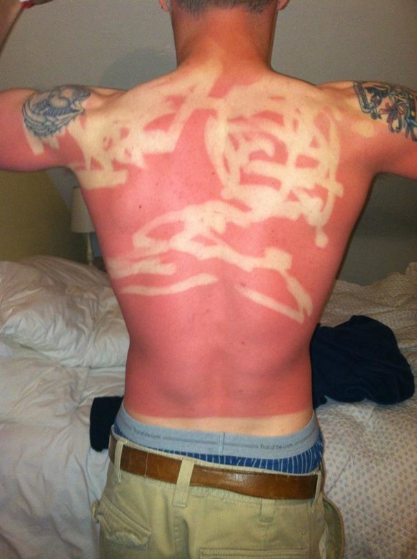 Durva leégések: ez történik a bőröddel, ha nem figyelsz rá