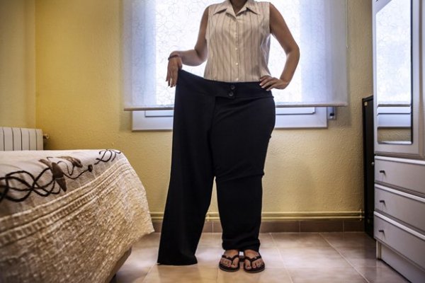 10 fotó a gyomorműtéttől az 50 kilós fogyásig 10 fotó a gyomorműtéttől az 50 kilós fogyásig